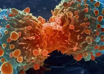 Alimentul care răspândește celulele canceroase în tot corpul. Renunță la el cât mai rapid