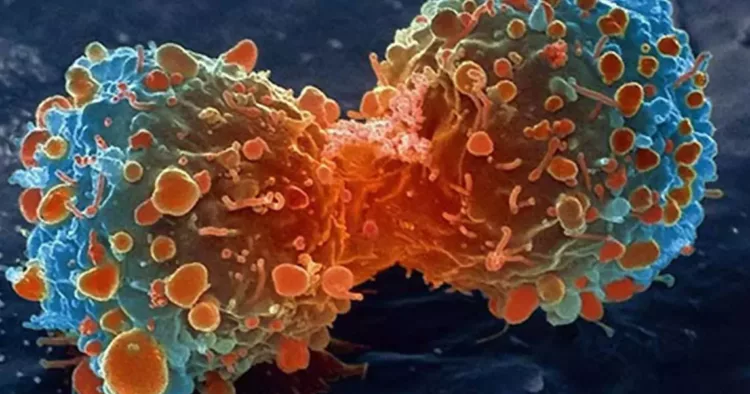 Alimentul care răspândește celulele canceroase în tot corpul. Renunță la el cât mai rapid