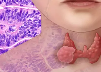 Glanda tiroidă controlează întregul organism. Iată cum o mențineți sănătoasă!