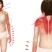 Nu neglijați durerile de spate. 80% dintre români se confruntă cu aceste probleme. vezi ce remedii poți folosi