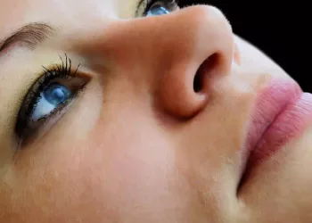 Ce este melanoza și cum o tratăm?