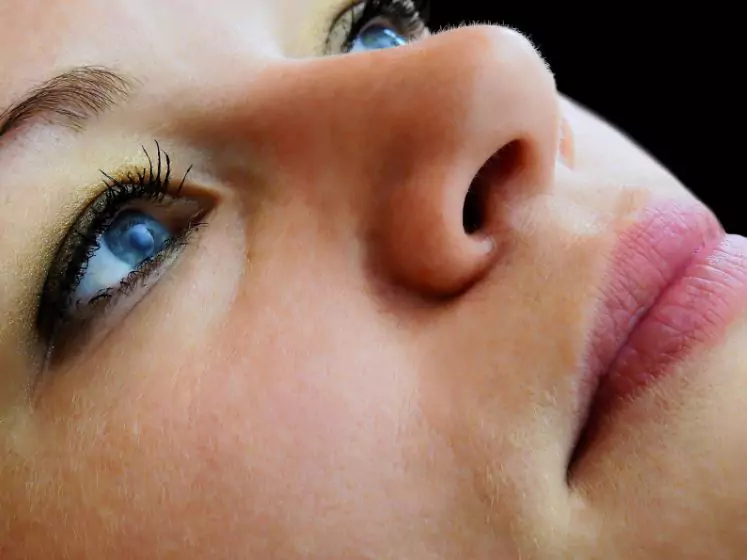 Ce este melanoza și cum o tratăm?