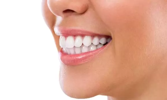 Albirea dentară laser – dinți albi și sănătoși în doar 30 de minute