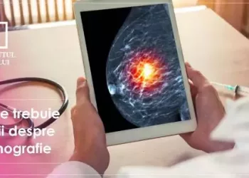 Tot ce trebuie să știi despre mamografie