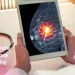 Tot ce trebuie să știi despre mamografie