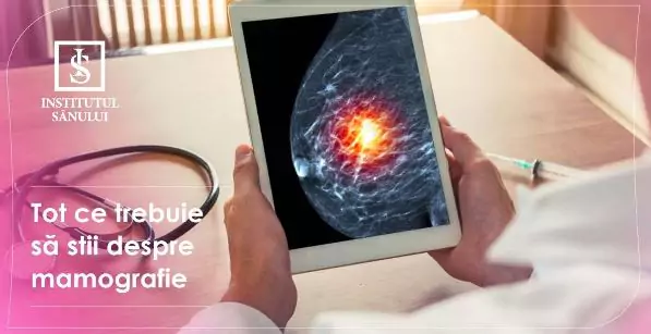 Tot ce trebuie să știi despre mamografie