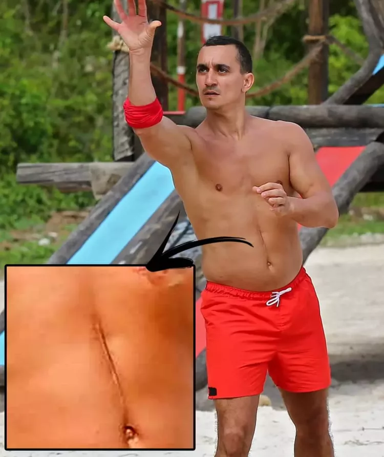 Am aflat adevărul! De unde provine, de fapt, cicatricea imensă de pe abdomenul lui Marian Drăgulescu de la Survivor