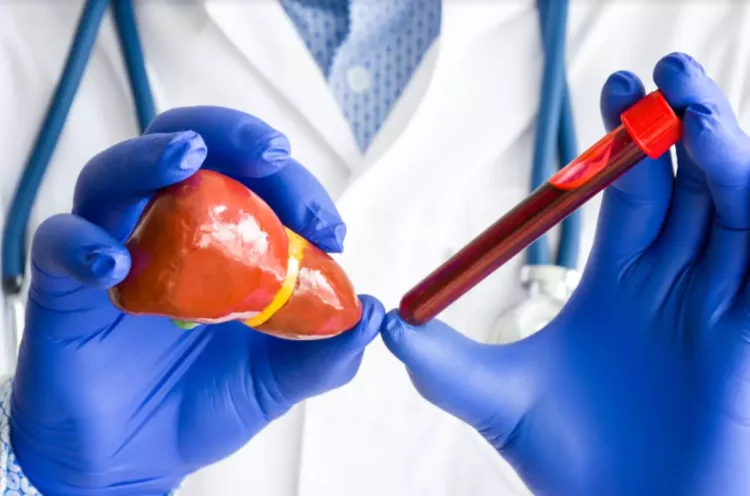 Afecțiuni care modifică valorile TGO