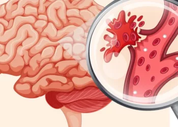 Poti sa ai un accident vascular cerebral(AVC) si tu sa nici nu stii. La ce trebuie sa fii atent