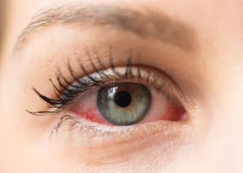 Cum să identifici semnalele care ar putea indica necesitatea unei consultații la ochi