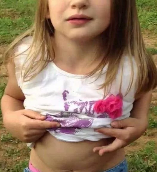 Fetita s-a plâns de dureri de burtă în timpul orelor. Profesorul a trimis-o la cabinetul medical. Descoperirea șocantă făcută de medici. Ce au găsit în burta micuței