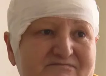 Caz uimitor la Iași. Ce i s-a întâmplat unei femei după ce medicii i-au înlăturat o tumoră uriașă de pe creier – „Toți ne-am speriat și de asta îmi vine să plâng acum”