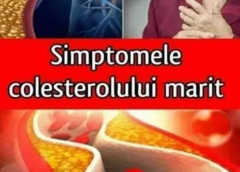 Cele 10 simptome ale nivelului crescut de colesterol