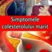 Cele 10 simptome ale nivelului crescut de colesterol