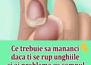 Ce trebuie sa mananci daca ti se rup unghiile si ai probleme cu somnul