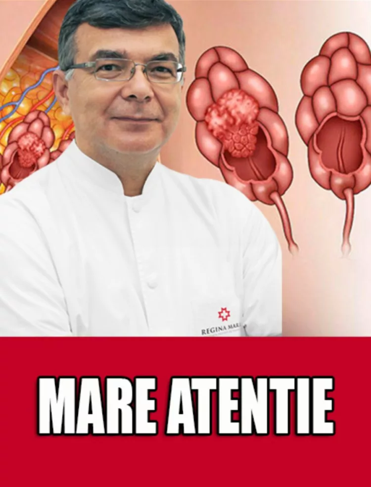Dr. Alexandru Blidaru: „Cel mai frecvent prim simptom al cancerului de san”