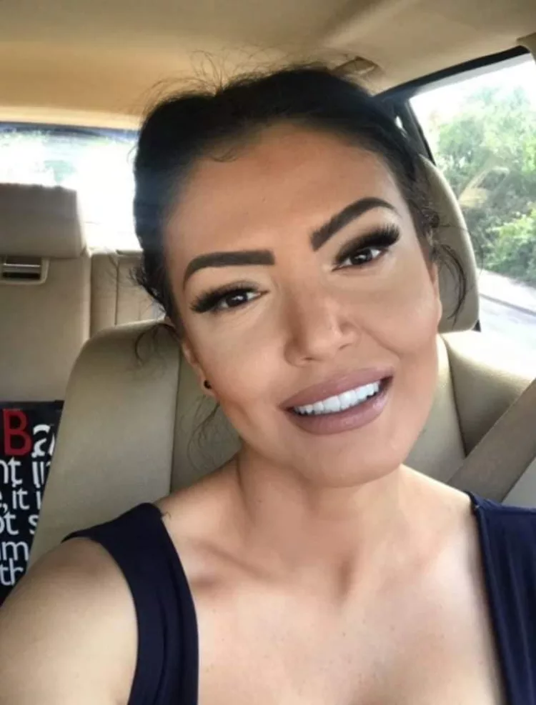 Declarațiile frumoasei brunete: Un cancer foarte agresiv, care creștea foarte repede