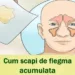 Cum scapi de felgma acumulata în gât sau nas