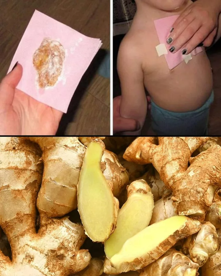 Comprese cu ghimbir – Elimină mucusul din plămâni într-o singură noapte și vindecă tusea