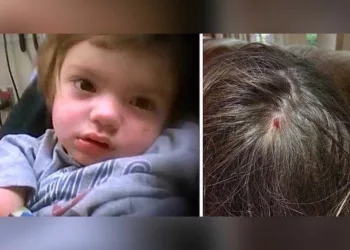 Și-au culcat copilul sănătos tun, de dimineață l-au găsit paralizat, nu mai putea nici înghiți! Când l-au dus la urgențe, medicii și părinții au fost uimiți de ce i-au găsit în spatele urechii. Ce avea copilul