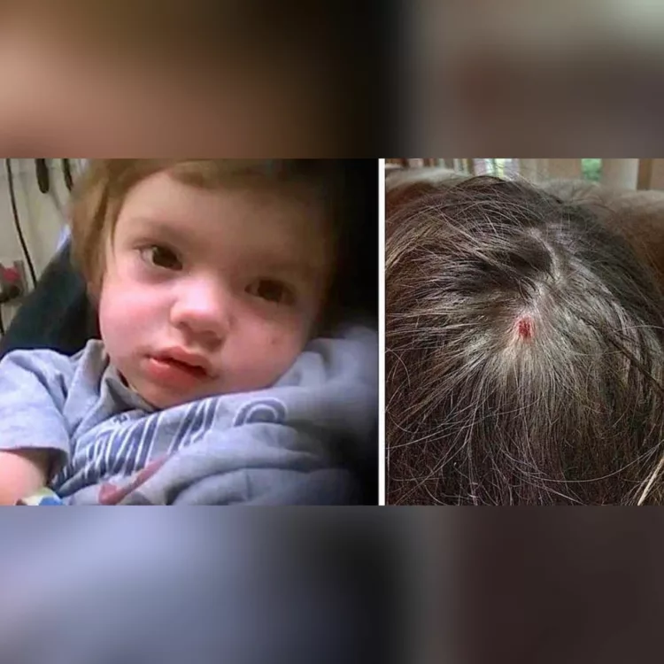 Și-au culcat copilul sănătos tun, de dimineață l-au găsit paralizat, nu mai putea nici înghiți! Când l-au dus la urgențe, medicii și părinții au fost uimiți de ce i-au găsit în spatele urechii. Ce avea copilul