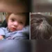 Și-au culcat copilul sănătos tun, de dimineață l-au găsit paralizat, nu mai putea nici înghiți! Când l-au dus la urgențe, medicii și părinții au fost uimiți de ce i-au găsit în spatele urechii. Ce avea copilul