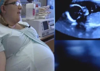 La 3 luni de la căsătorie a rămas însărcinată, dar la prima ecografie, doctorii au rămas șocați când s-au uitat la ecran: „Așa ceva se întâmplă o dată la 15 milioane de nașteri” Ce avea femeia în ea e unic, nici acum nu-i crede nimeni…