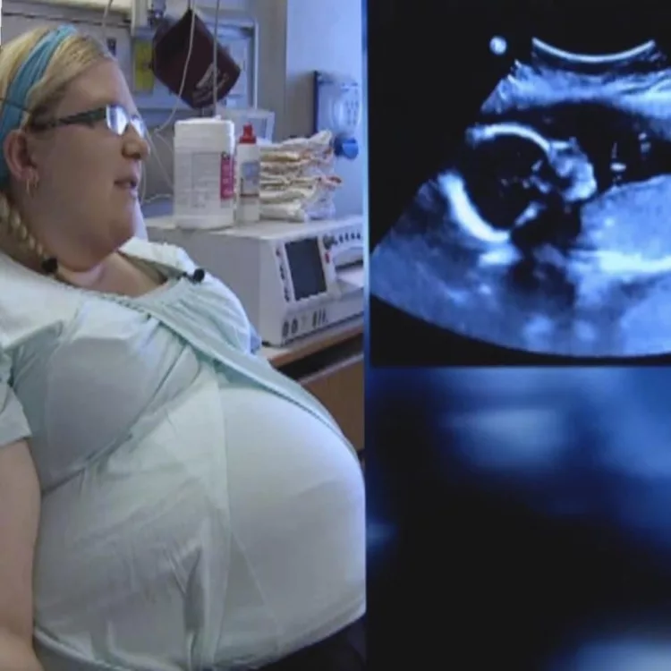 La 3 luni de la căsătorie a rămas însărcinată, dar la prima ecografie, doctorii au rămas șocați când s-au uitat la ecran: „Așa ceva se întâmplă o dată la 15 milioane de nașteri” Ce avea femeia în ea e unic, nici acum nu-i crede nimeni…