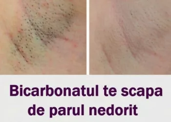 Descopera: Bicarbonatul te scapă de părul nedorit pentru totdeauna – Iata cum trebuie folosit