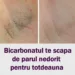 Descopera: Bicarbonatul te scapă de părul nedorit pentru totdeauna – Iata cum trebuie folosit