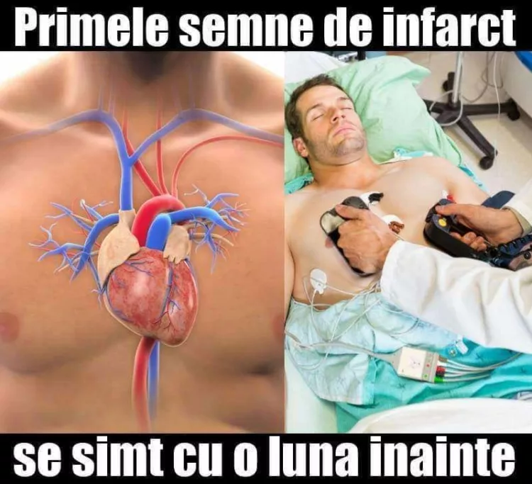 Infarctul dă primele semne cu o lună înainte, numai că nu știm să le recunoaștem. La ce trebuie să fim atenți