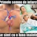 Infarctul dă primele semne cu o lună înainte, numai că nu știm să le recunoaștem. La ce trebuie să fim atenți