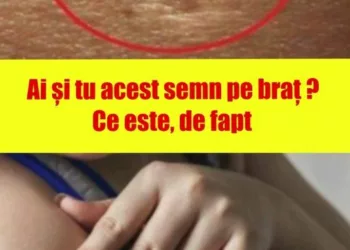 Probabil ai observat si tu ca exista anumite persoane care au o cicatrice rotunda in partea de sus a bratelor. Probabil o ai și tu.