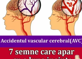 Primele SIMPTOME care apar Cu 1 LUNĂ înainte de ACCIDENTUL VASCULAR CEREBRAL(AVC)