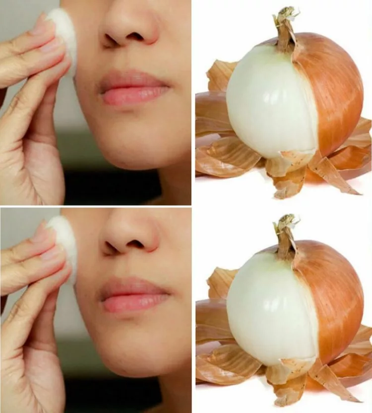 Nu vei mai arunca foile de ceapă după ce auzi asta – Ce miracole fac în 2 minute ….