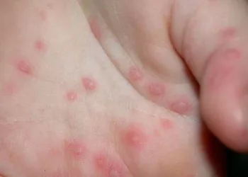 Ce e mai rău abia urmează! Avertisment șoc pentru România și toată Europa