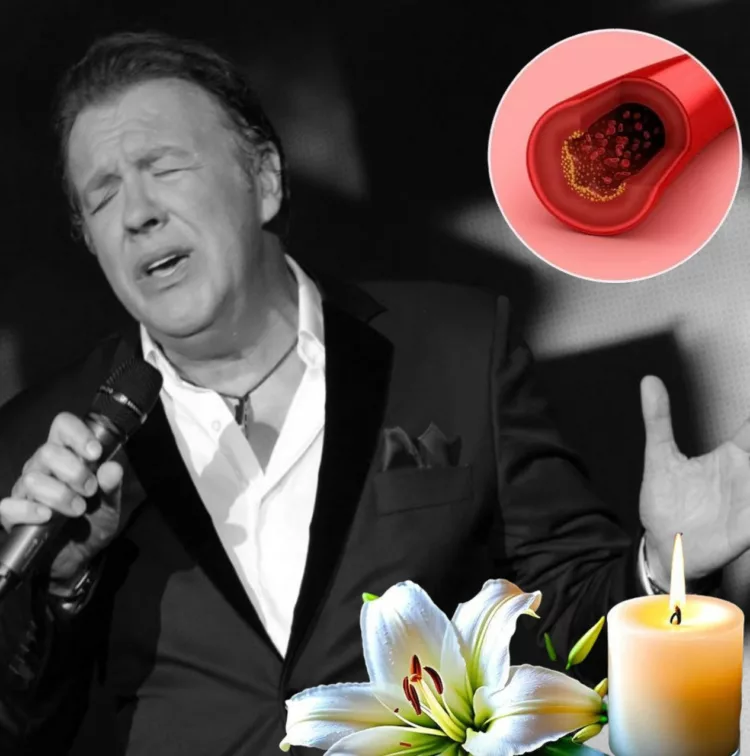 Semnele care te anunță că ai un AVC, mulți le ignoră. Aceasta a fost cauza decesului și lui Gabriel Cotabiță