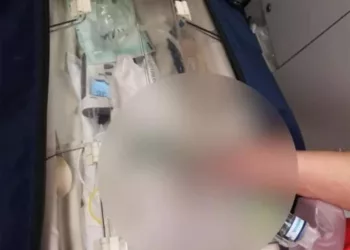 Caz IREAL în Maternitatea Botoșani! O graviduță de 19 ani a născut un bebeluș microsom