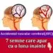 Semnalele tăcute ale unui accident vascular cerebral: simptome care pot apărea cu o lună înainte de AVC