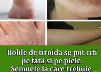 Ce semne de pe față pot indica afecțiuni ale ficatului și tiroidei