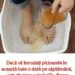 Tratamentul natural care ameliorează infecții, dureri musculare și oboseala picioarelor
