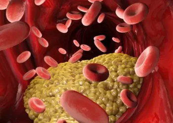 Colesterolul mărit: semnul nocturn care îți poate salva viața. Ce simptome nu trebuie ignorate