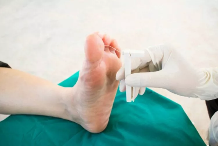 Sindromul piciorului diabetic – o complicație gravă a diabetului zaharat. Cum se manifestă și cum poate fi prevenită amputarea