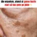 Petele maronii pe piele: de ce apar și cum le putem preveni