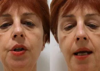 Zvonuri și panică pe rețelele sociale: medicul Flavia Groșan este în viață, dar se află în stare gravă la spital