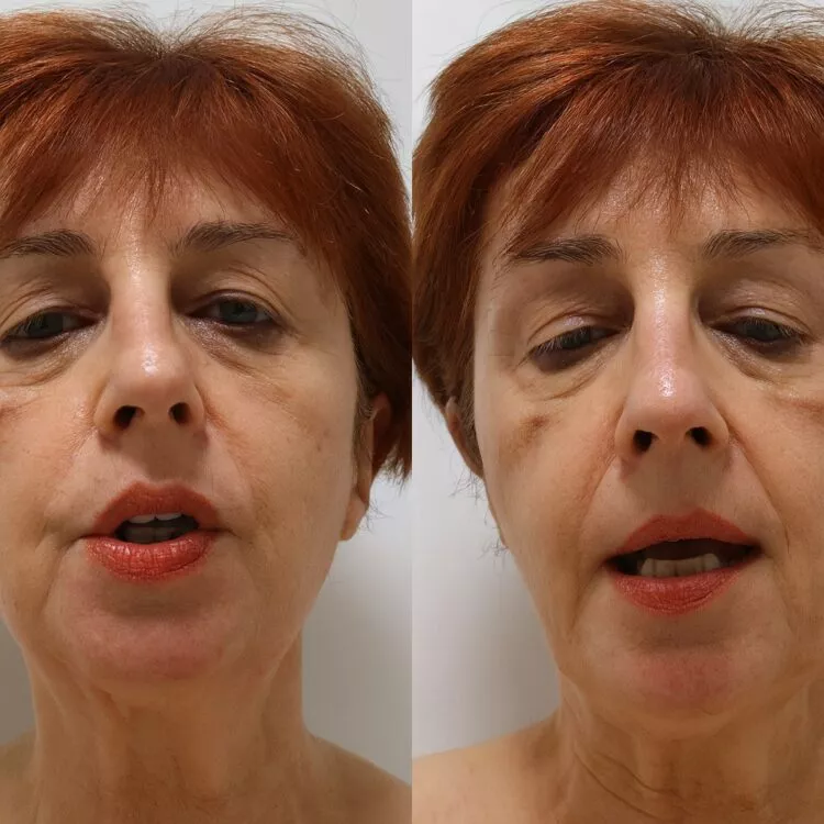 Zvonuri și panică pe rețelele sociale: medicul Flavia Groșan este în viață, dar se află în stare gravă la spital