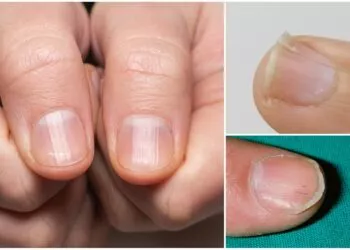 Testul simplu de la degete care poate semnala o problemă gravă la plămâni