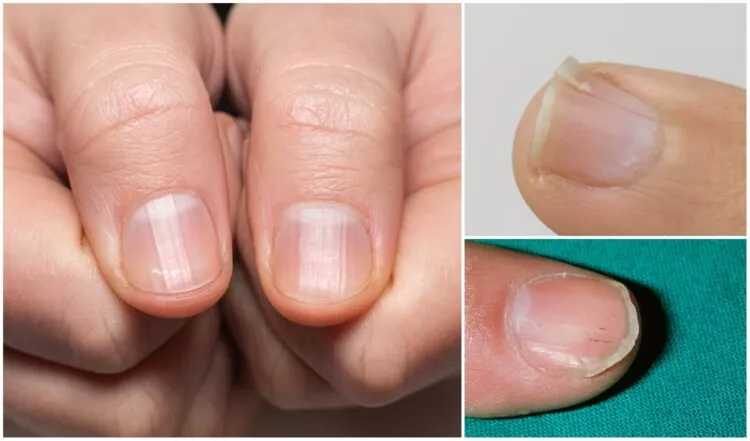 Testul simplu de la degete care poate semnala o problemă gravă la plămâni