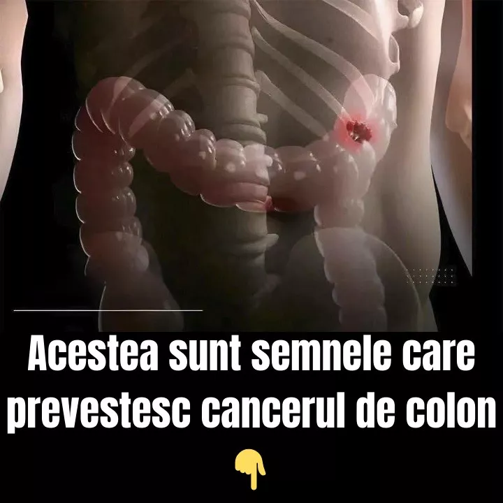 Susținerea Sănătății Colonului Prin Alimentație: 5 Alimente-Cheie pentru „Curățarea” Naturală