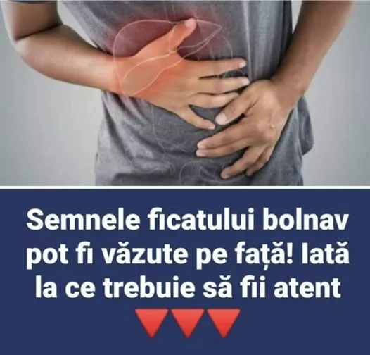 Ficatul gras: ce este, care sunt cauzele și ce semne pot apărea pe față